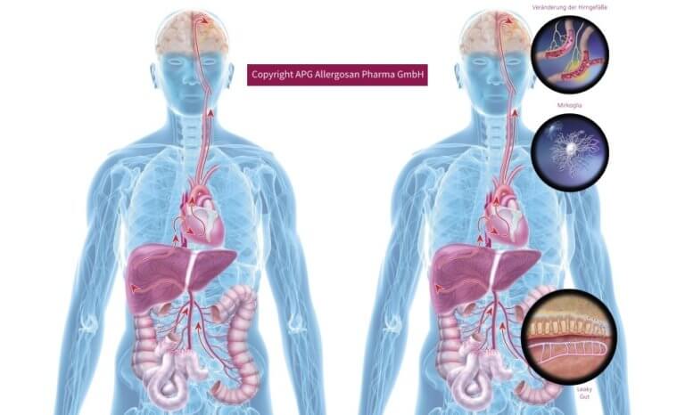 Leaky Gut – Praxis Integrativ – Sabine Redmann